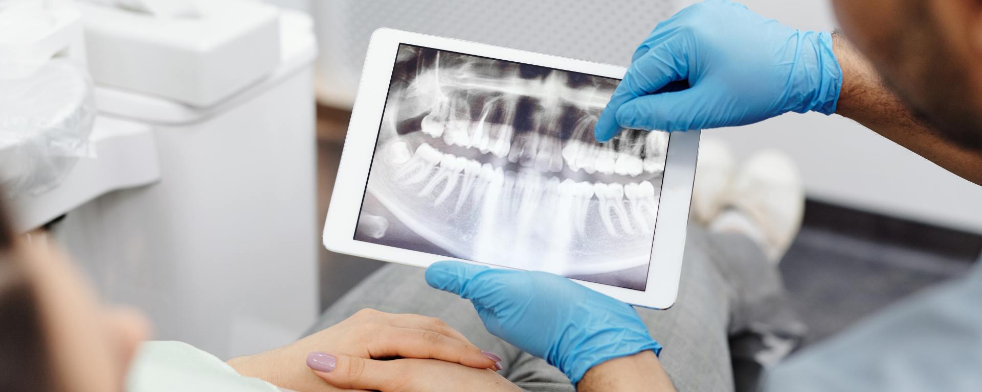dentist wearing gloves showing patient dental x-ray